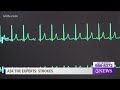 Ask The Experts Strokes