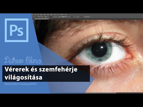 a látás élesítése