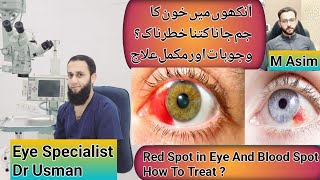 ankh me lal nishan | red spot in eye | ankh me lal nishan ka ilaj | dr usam abid