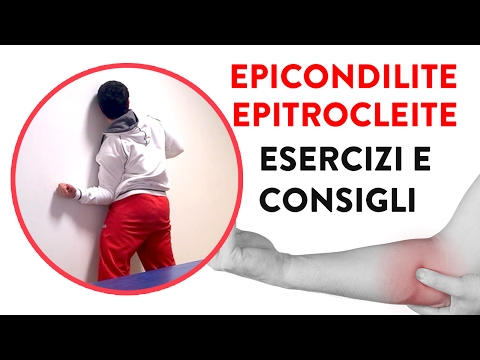 Giunti Uzi nel Nord-Est Concentrazioni di sale nelle articolazioni