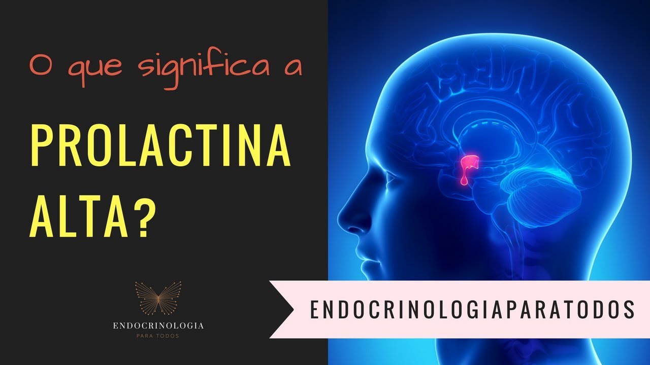 PROLACTINA Alta - Quais os sintomas e as causas?