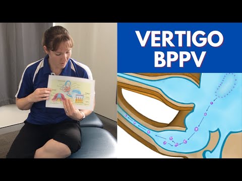 Benign Paroxysmal Positional Vertigo (BPPV) - Physiotherapy Treatment