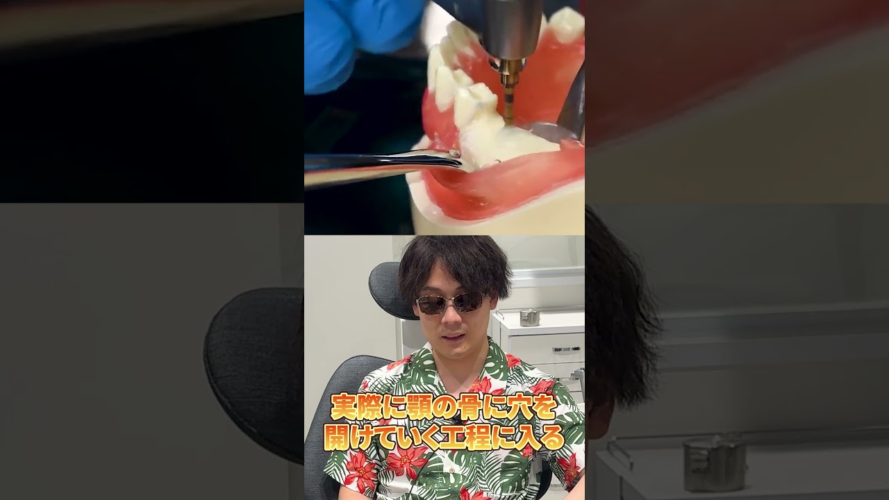 【海外治療動画を見る】インプラント  #歯科医 #歯科医師 #歯科治療