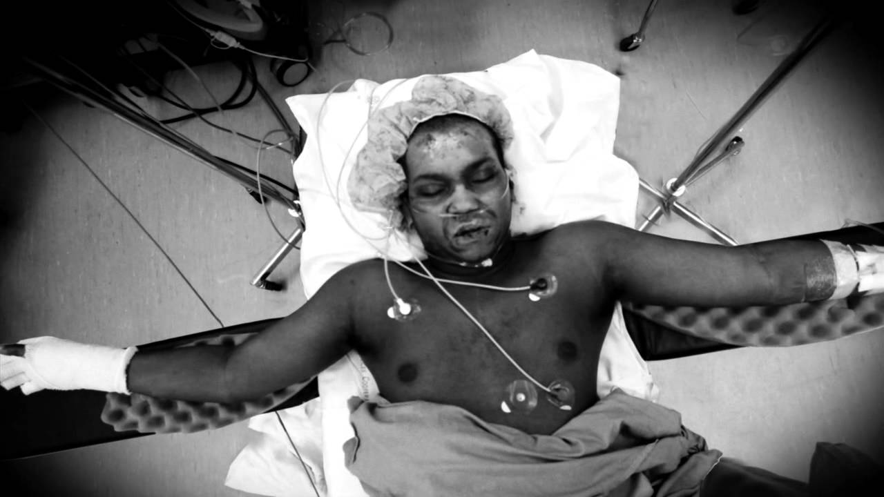 After The Fire (Trailer)