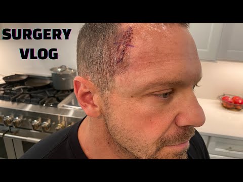 LEANER BY THE DAY - DAY 39 - GETTING MY CANCER REMOVED VIDEO TAKEN DURING THE PROCEDURE!