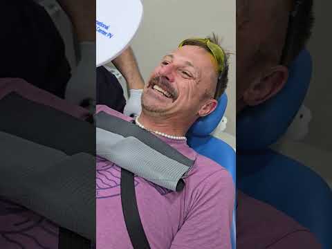 Transforming Smiles on a Budget: Dental Veneers Procedure in Puerto Vallarta, Mexico