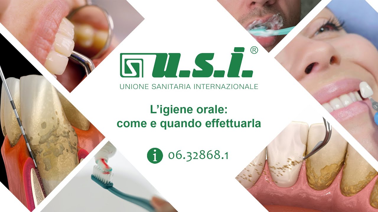 USI - Igiene Dentale: come e quando effettuarla per una salute orale ottimale