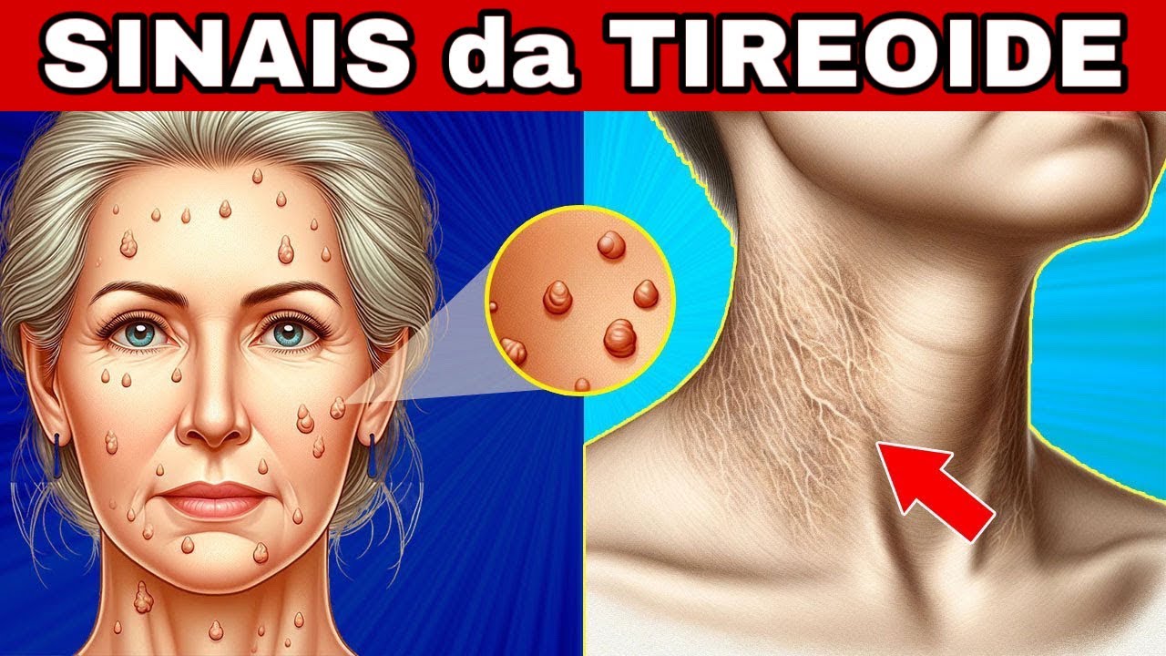 🚨 8 SINAIS de ALERTA da TIREOIDE (Hipotireoidismo e Hipertireoidismo)