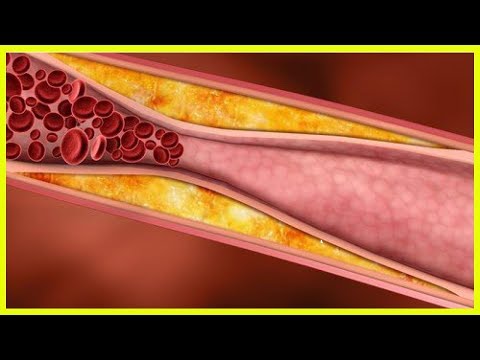 Die Antibiotika gegen das Ekzem Die Behandlung der Schuppenflechte welche Salben