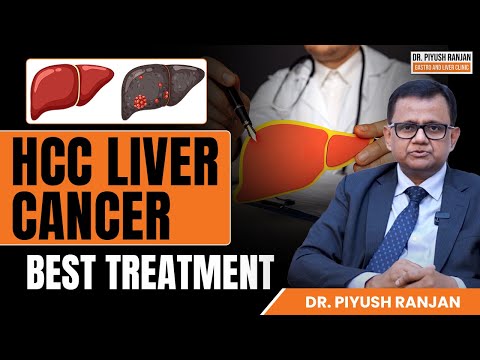 HCC Liver Cancer Treatment | Primary Liver Cancer | Dr. Piyush Ranjan, Delhi