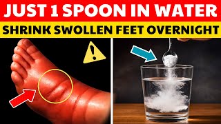 7 Bedtime Fixes To Drain Swollen Feet Overnight | Senior Health Tips