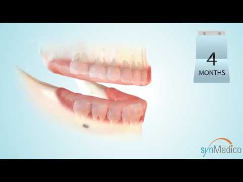 Kinderzahnheilkunde im ZMK Lübeck