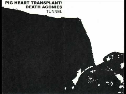Pig Heart Transplant - Monitored Viewing