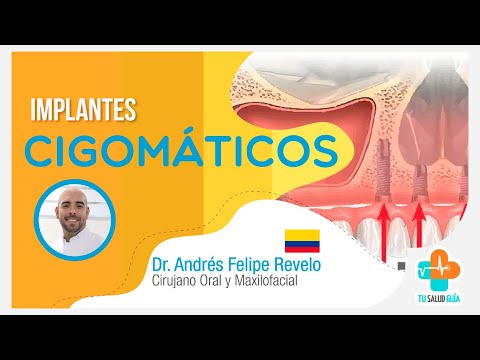 Zygomatic Implants | Reporte Dental