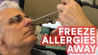 Freeze your allergies away with this treatment