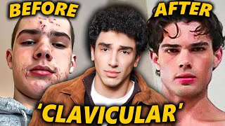 Clavicular: The Internet's Prettiest Incel MQDEFAULT Thumbnail