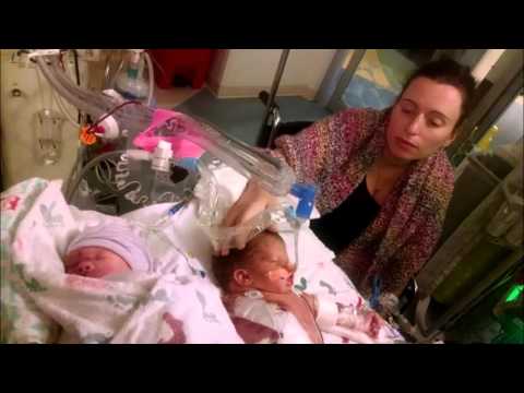 Conjoined Twin Mother Banned