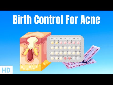 Sunburn Causes Signs and Symptoms Diagnosis and Treatment