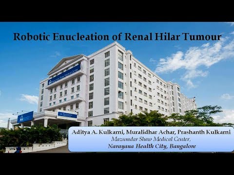 Robotic Enucleation of Renal Hilar Tumour