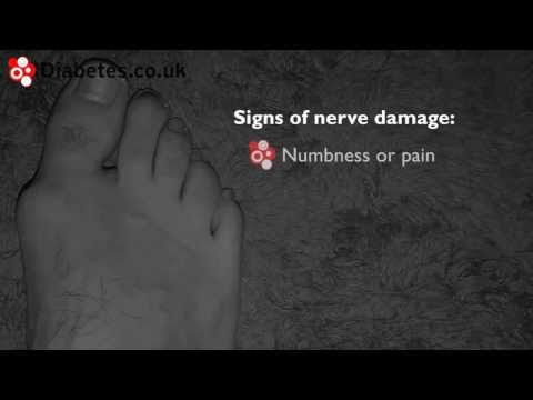 How to Check Your Feet For Signs of Nerve Damage
