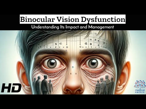 Binocular Vision Dysfunction: From Diagnosis to Management