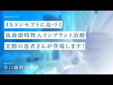 第201話 札幌駅前初‼️本物の4S抜歯即時埋入インプラント治療❗️第2弾-実体験された患者さん -４S即時荷重は患者さんに優しいインプラント治療