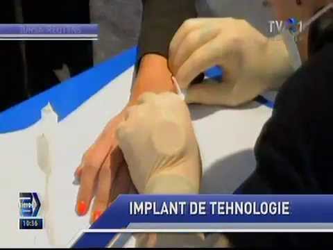 Microcip implantat in palma la Epicenter