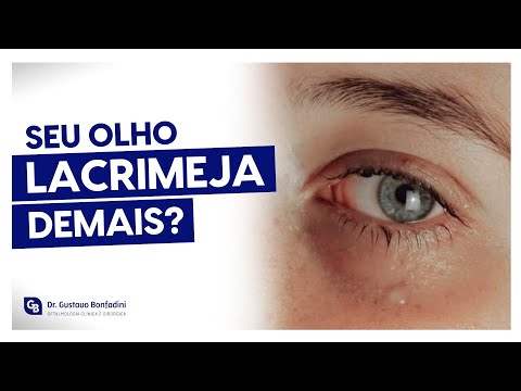 DO YOUR EYES TREAT TOO MUCH? IT COULD BE DRY EYE!