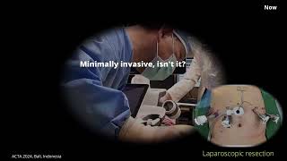 [Conference Talk] ACTA 2024 Talk Final (Live)