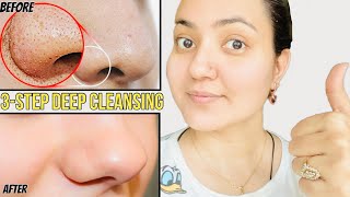 3-Step Deep Cleansing Facial To Reduce Pores/Blackheads/Acne Scars/Pimple Marks & Excess Oil