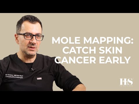 Mole Mapping & Early Skin Cancer Detection with Dr. Christos Kasparis | The Health Suite Leicester