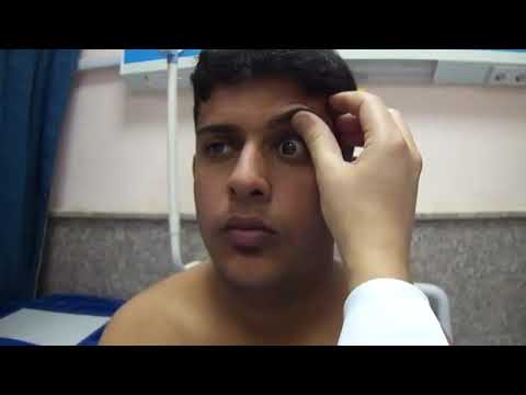 22- Thyroid Status Examination, Eye signs(Dr. Rajooj)
