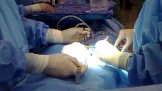 APPENDECTOMY part 3 instruments setup
