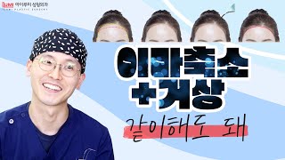 #이마축소 #이마거상 간단 정리 ???? 하는 김에 한번에? #아이루미성형외과
