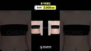 한달 만에 팔 라인이 이렇게 달라짐;;