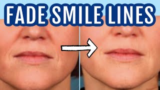 12 ways to fade smile lines (nasolabial folds)| Dr Dray