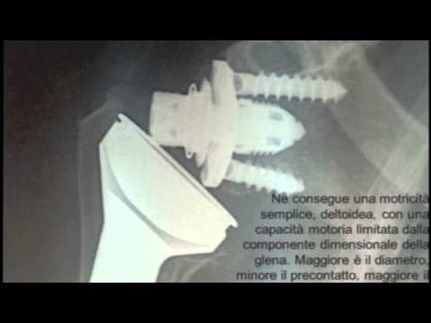 Trovare Spine Corsetti di osteocondrosi indietro