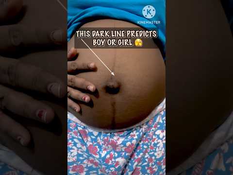 Pregnancy dark line on belly II Linea Nigra II #viral #shorts #youtubeshorts #pregnancy