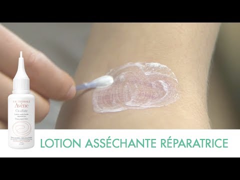 comment soigner irritation de la peau