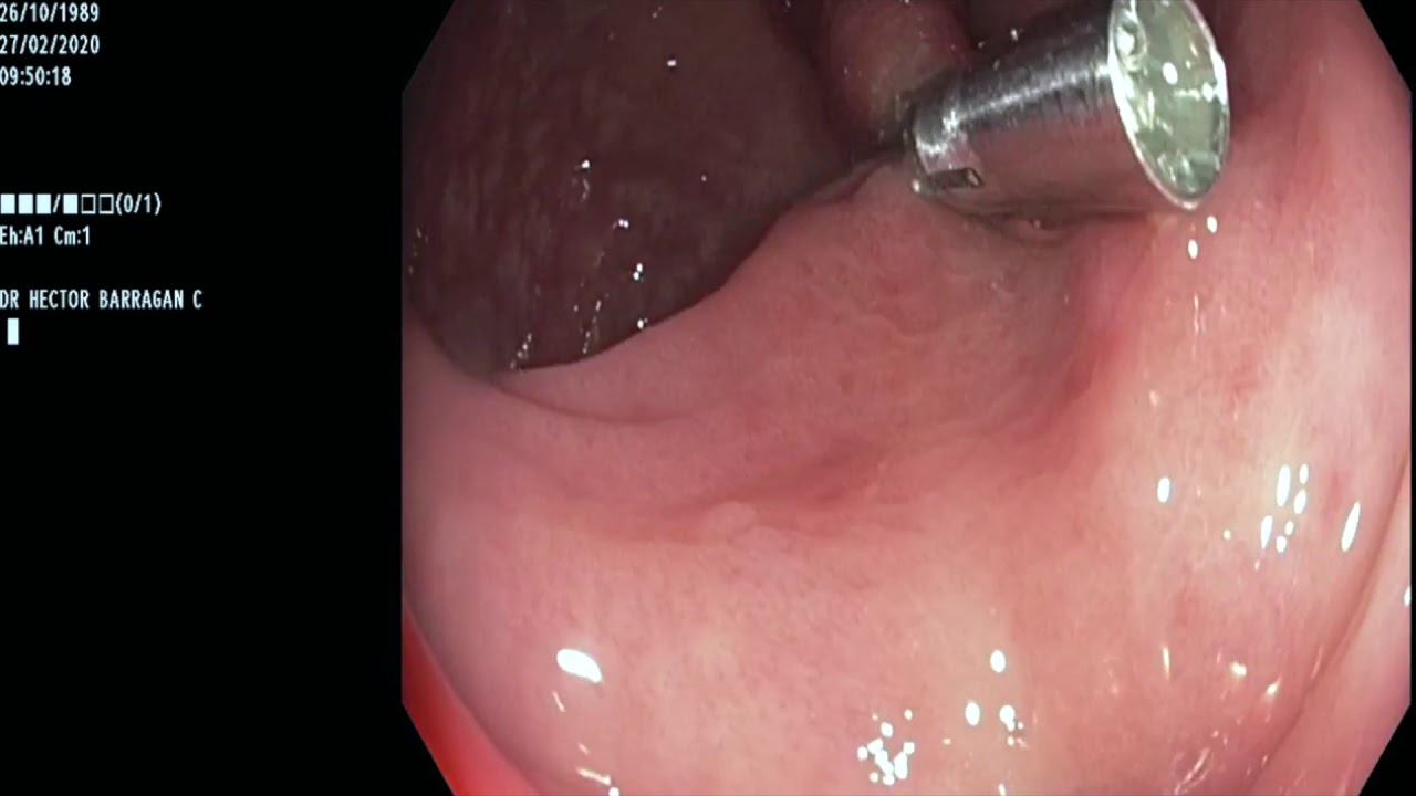 Héctor Hugo Barragán Córdova-5