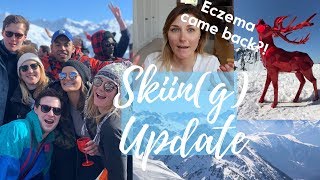 3 Eczema Triggers Make Your Skin Itchy. HOW to Protect Skin While Skiing | HEAL ECZEMA NATURALLY