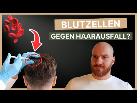 Hilft PRP gegen Haarausfall? Arzt klärt auf.