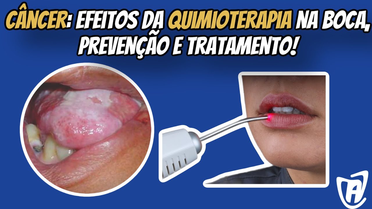 Francisco De Assis Almeida Lima Júnior-58