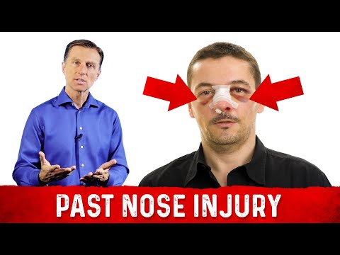 Deeper Causes of Pain Inflammation – Dr Berg