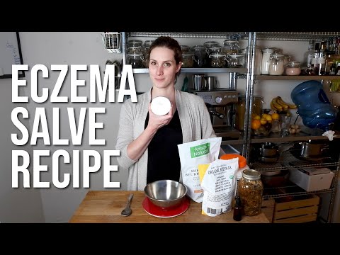 Baby Eczema Salve Recipe  | How We Got It Under Control For $80.00/Year.