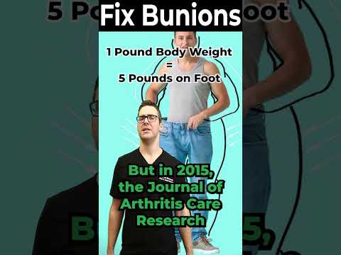 TOP 13 Ways to Shrink Bunions Naturally 1 HUGE SECRET