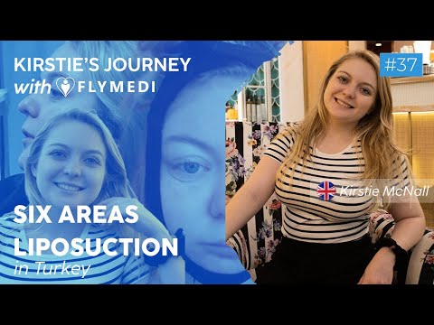 Empowering Women: Kirstie's Inspiring 6-Area Liposuction Success with Flymedi in Turkey