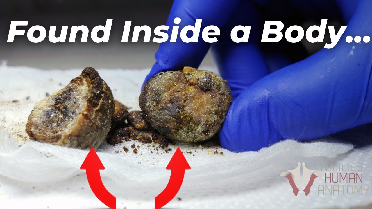 You Don't Want These Inside of You