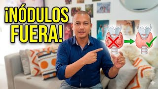¿Cómo Eliminar Nódulos Tiroideos sin Cirugía? 