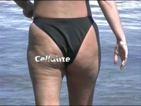 Probleme bei der Behandlung der Halswirbelsäule Warum steife Gelenke am Morgen